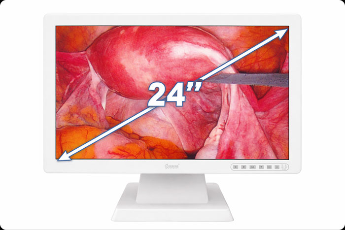 Monitor
